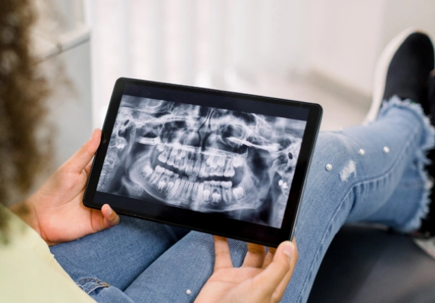 Person holding tablet displaying dental X-ray in clinical setting.