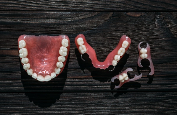 Dental models displaying natural teeth arrangement and orthodontic treatment progression on black surface.