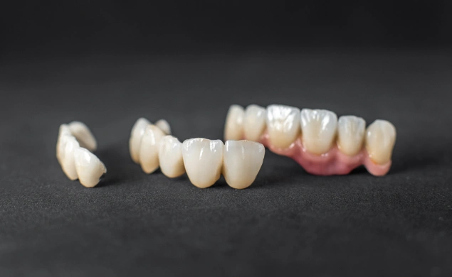 Dental crowns and bridges displayed on dark background showing restorative dentistry options.