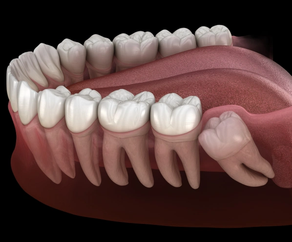 3D dental model showing natural teeth arrangement on pink gum tissue for cosmetic dentistry reference.