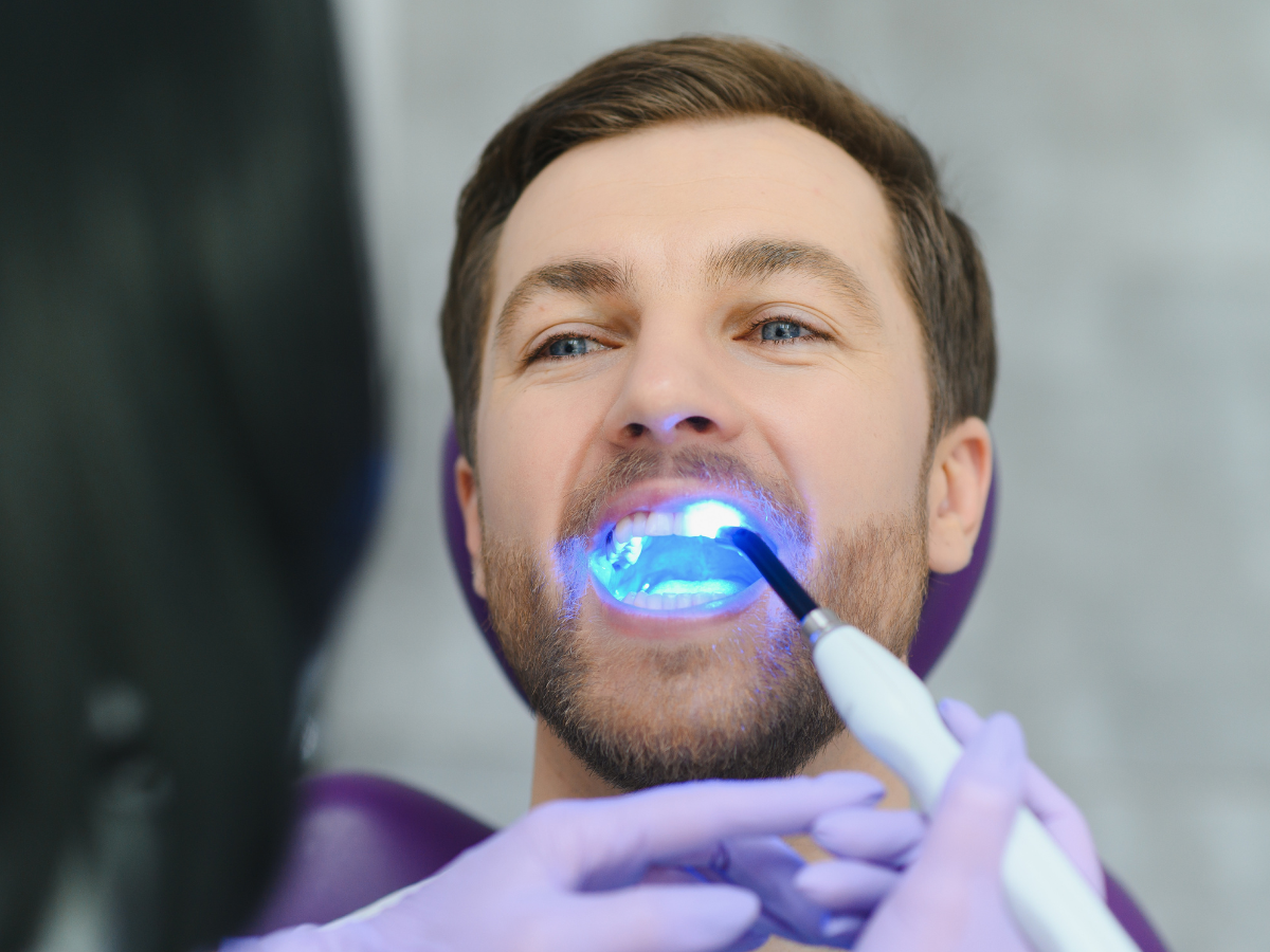 Professional Teeth Whitening Benefits vs Store Kits Tualatin Dentist